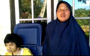 Sempat Dibantu Presiden Jokowi, Gadis Lumpuh di Pangandaran Ini Sudah 6 Bulan Tak Mampu Berobat
