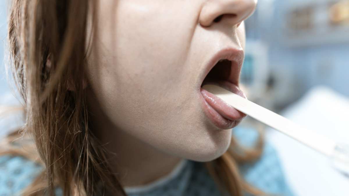 Penyebab dan cara mengatasi bibir pecah-pecah