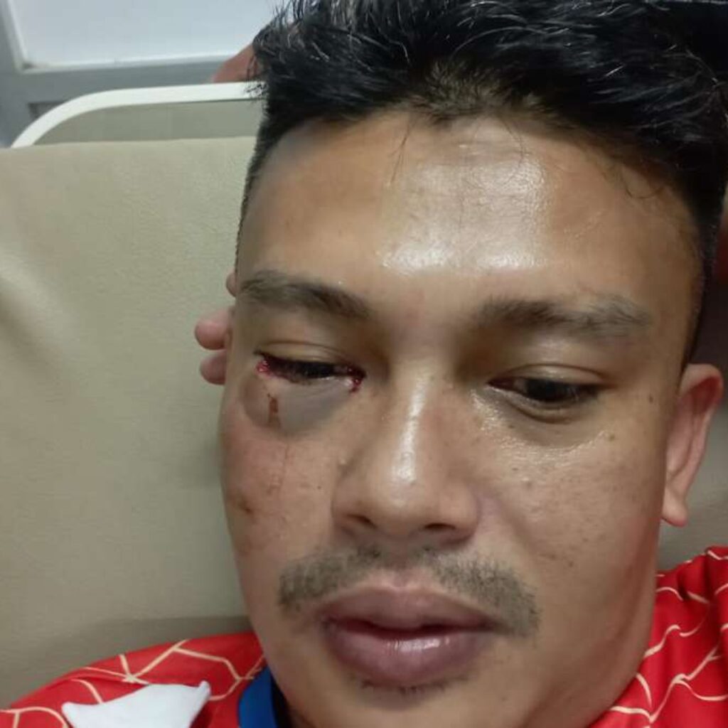 Miris! Wartawan Metro TV di Sumedang Dipukul Oknum Polisi, Matanya Berdarah