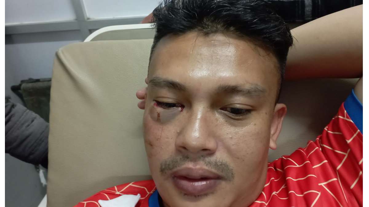 Kontributor Metro TV Sumedang Dipukul Oknum Polisi, Matanya Berdarah
