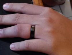 Cincin di Jari Manis Pelajar Tanjungsari Ini Susah Dilepas, Damkar Turun Tangan